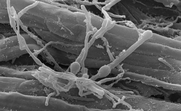 Control biológico para la mejora del crecimiento de las plantas